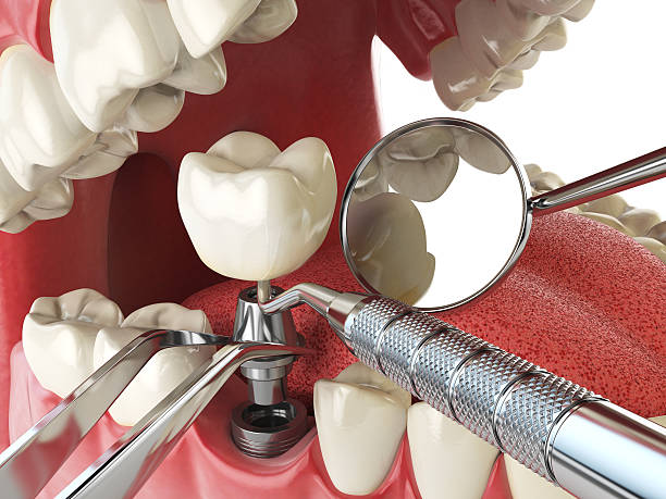 Best Emergency TMJ Treatment in Erwinville, LA